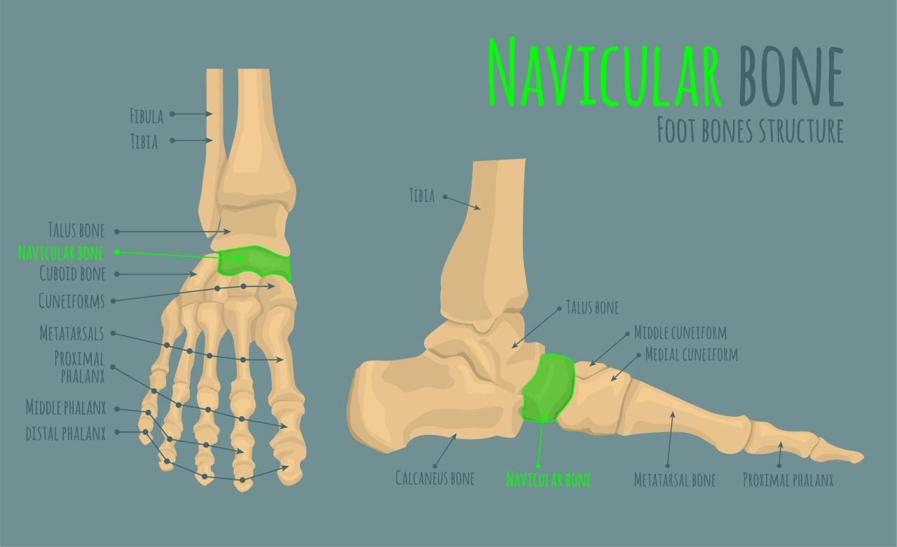 Classification of an Accessory Navicular | The Medical Dispatch